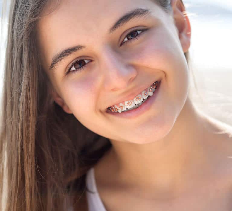 Braces Bowling Green, Russellville, Tompkinsville