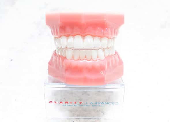 Invisalign® Bowling Green, Russellville, Tompkinsville