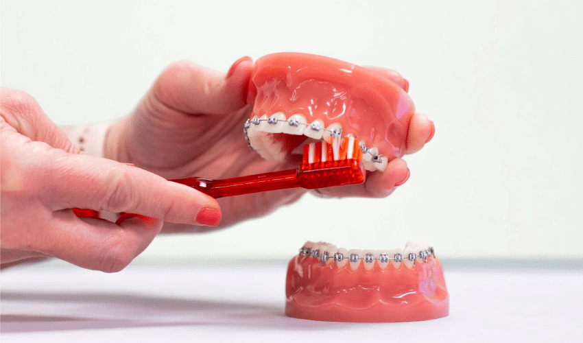 Featured image for “How Would You Know You Need Orthodontic Care?”
