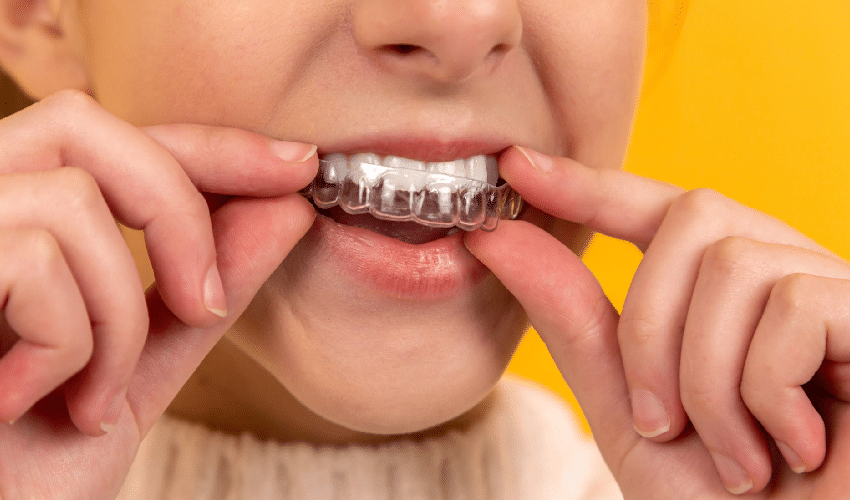 Featured image for “The Latest Innovations in Invisalign & Its Impact on Orthodontics”