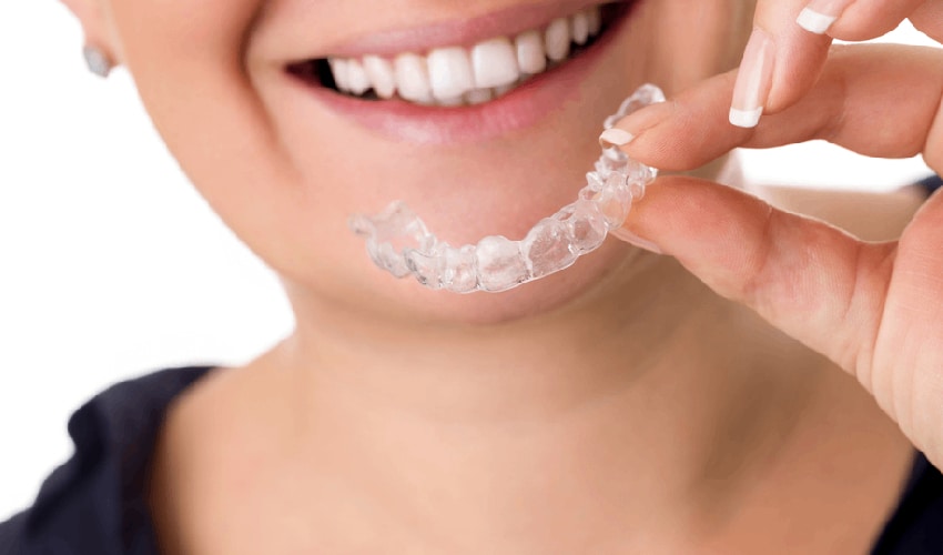 Featured image for “What to Expect During Invisalign Treatment?”