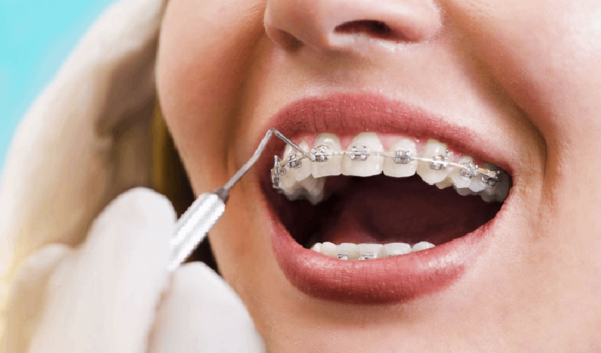 Featured image for “Smile Confidently: How Orthodontic Treatment Can Transform Your Teeth and Boost Self-Esteem”