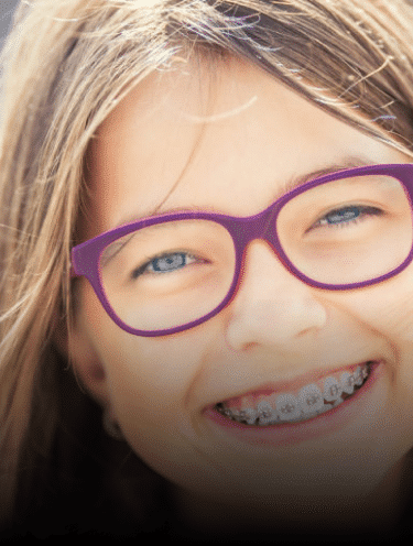 Braces Bowling-Green