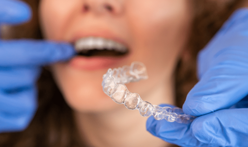 Featured image for “Foods to Avoid with Invisalign”
