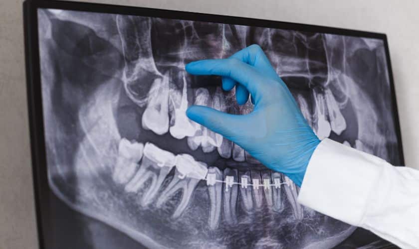 Featured image for “Is Orthodontic Treatment Necessary?”