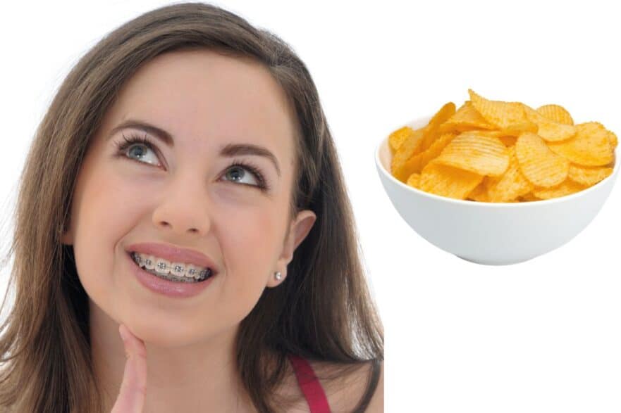 Can You Eat Chips with Braces