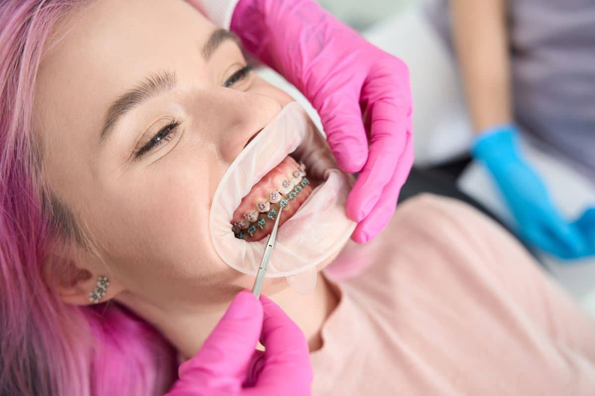 Featured image for “What Happens When Your Braces Are Removed?”