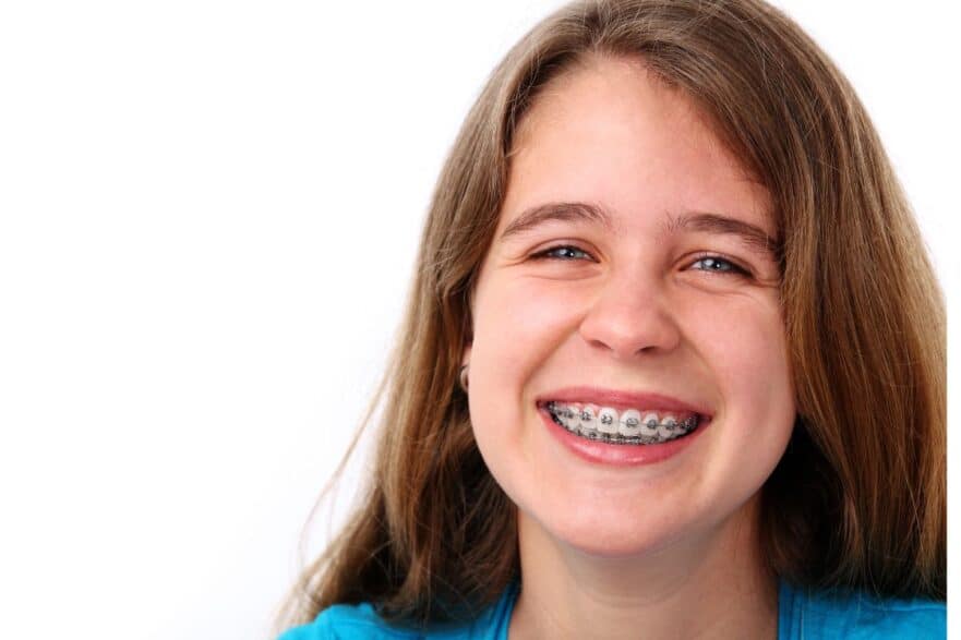 reduce braces anxiety in children