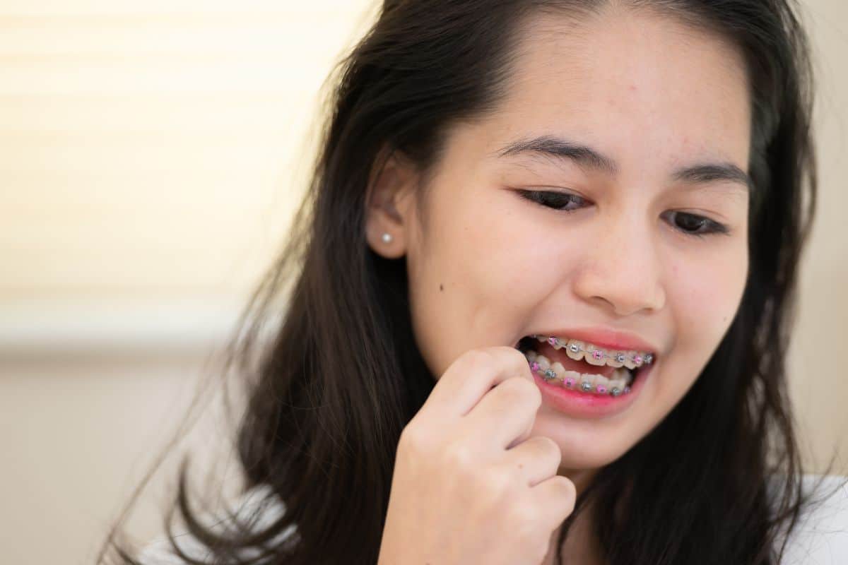 Featured image for “Braces Pain: Essential Tips for Surviving Your First Week”