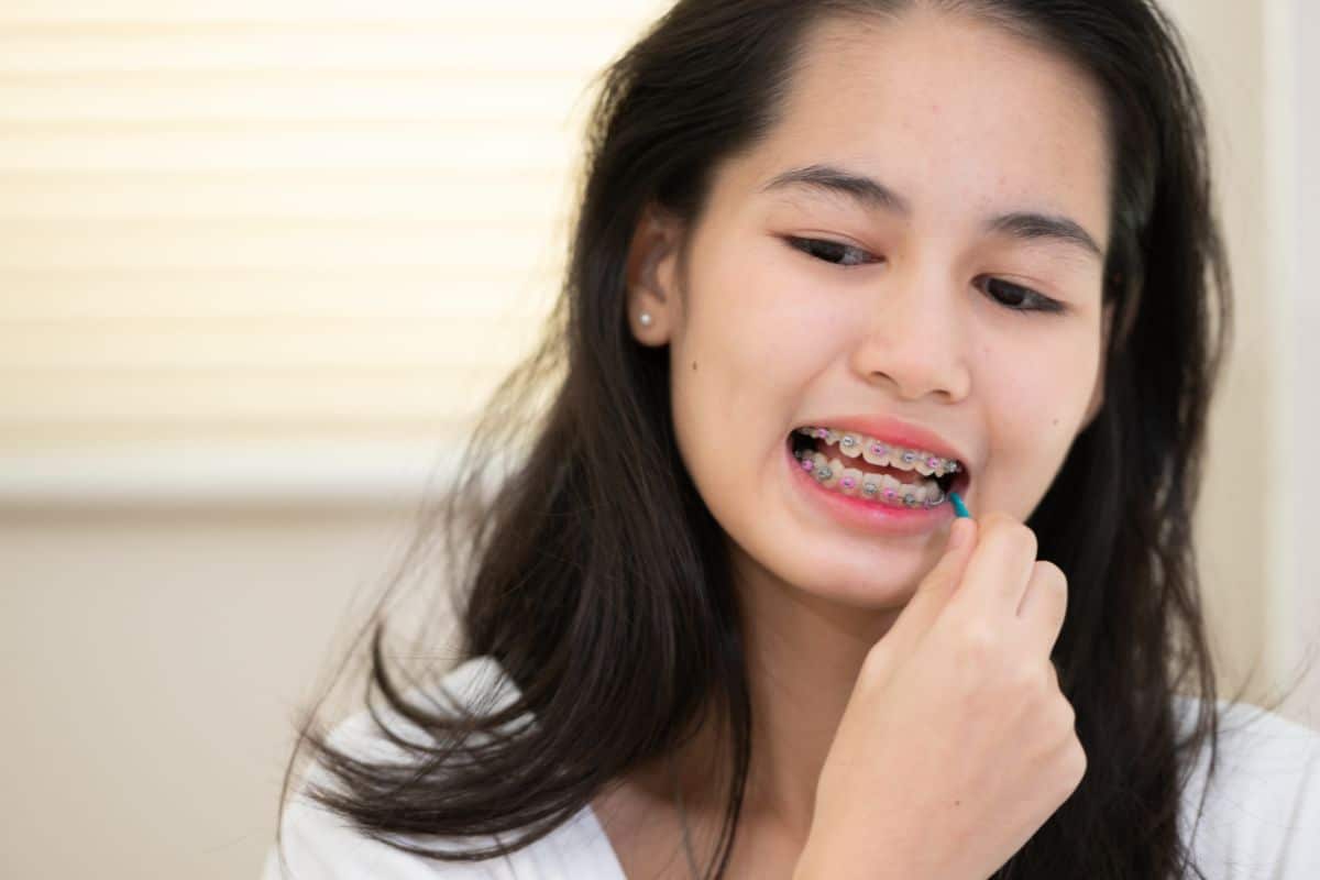 Featured image for “Why Your Braces Need Regular Adjustments for Optimal Results”