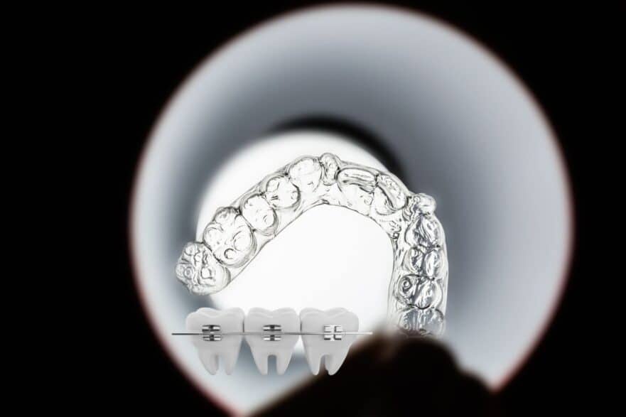 What to Do If You Break Your Braces or Clear Aligners