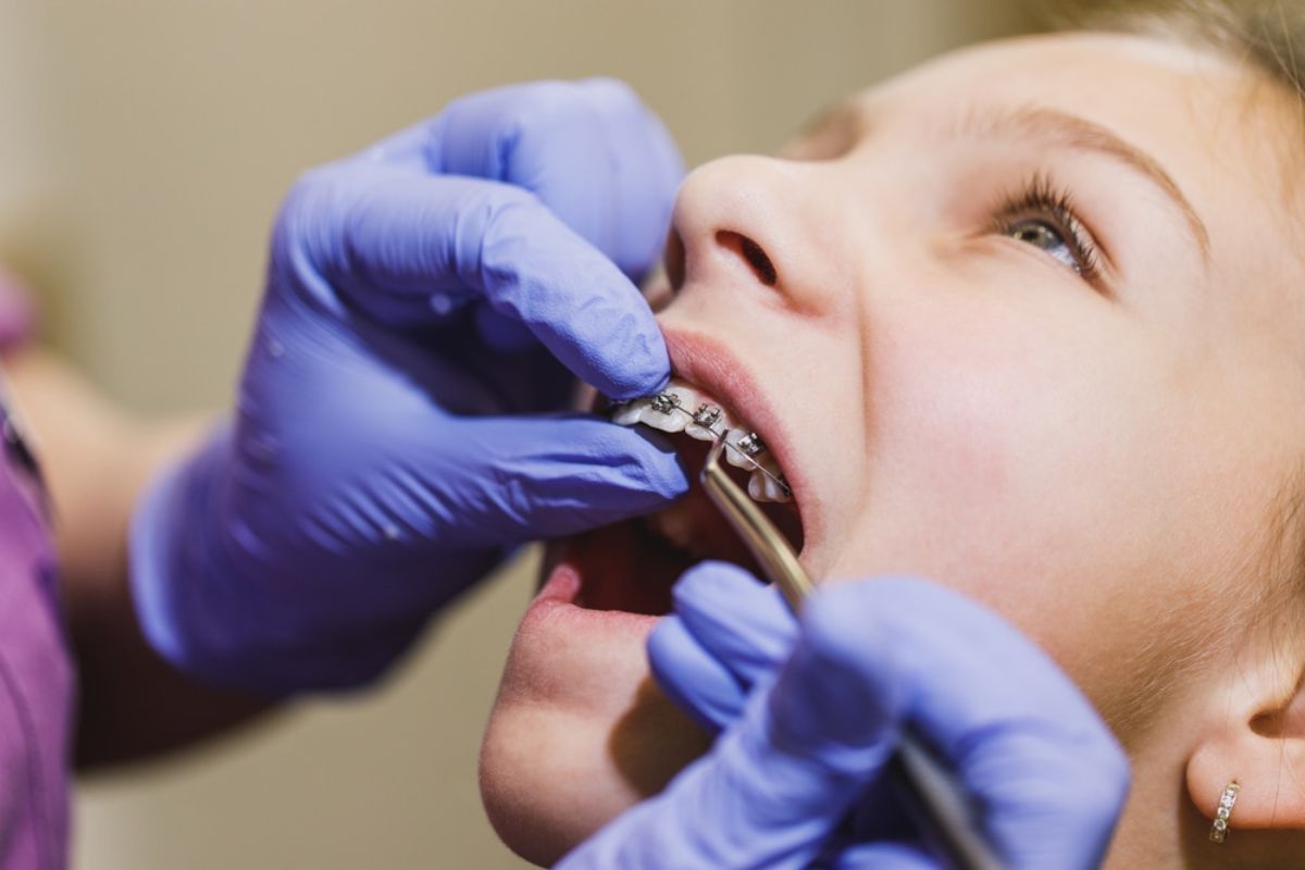 Featured image for “How Often Do Braces Get Adjusted? Your Guide to a Straighter Smile”