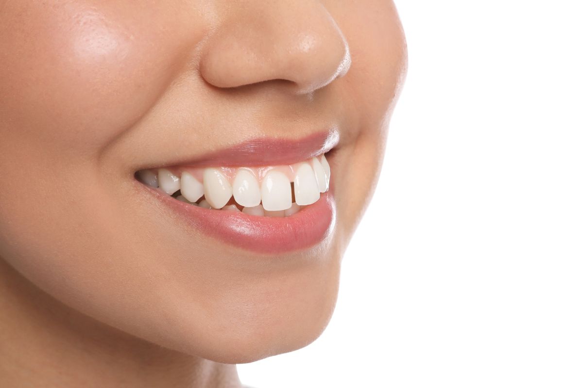 Featured image for “Can Teeth Gaps Be Closed Without Braces?”
