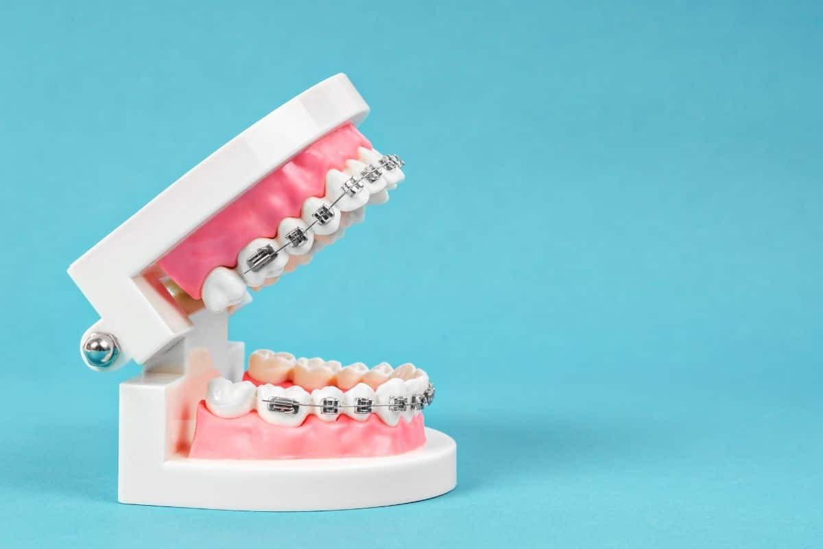 Featured image for “What to Do If You Have a Poking Wire or Broken Bracket”
