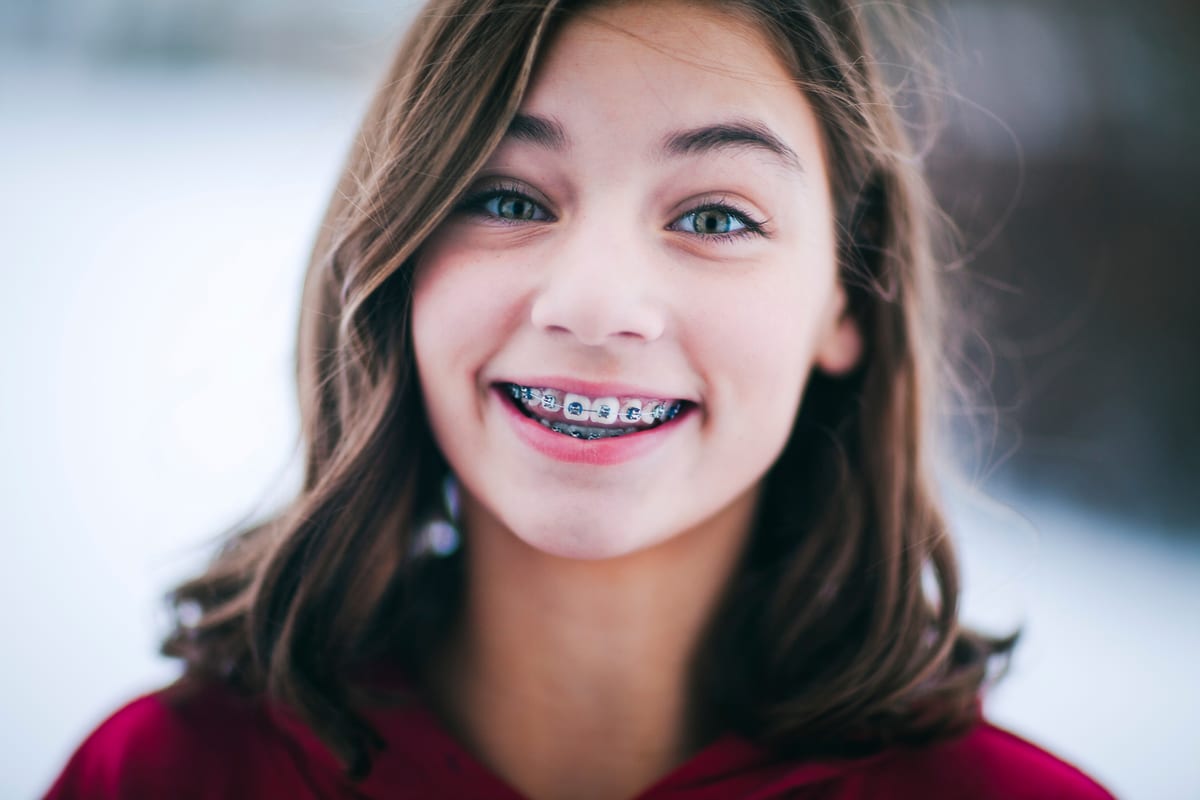 Featured image for “Why Delaying Braces Costs More Than You Think”